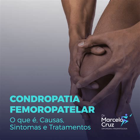 Condropatia Femoropatelar O Que Causas Sintomas E Tratamentos Dr