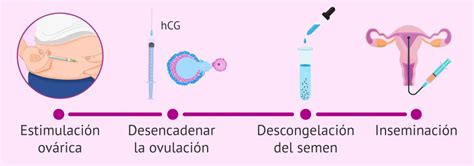 ¿pensando En Ser Madre Soltera El Futuro De La Medicina Reproductiva En La Costa Del Sol