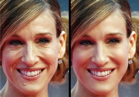 Photos Retouch Es Avant Apr S Recherche Google Chirurgie