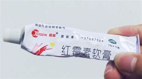 红霉素软膏不敢乱用？教你红霉素软膏3种妙用，能省不少钱