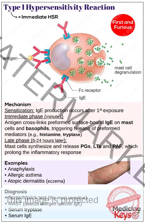 Type I Anaphylactic Hypersensitivity Reaction Medicine Keys For Mrcps