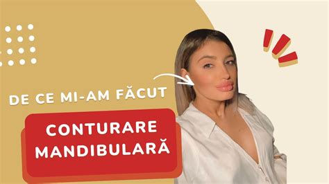 Cum Facem Procedura Jawline Cu Acid Hialuronic N Clinica Medlink