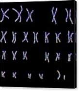 Normal Male Chromosomes Photograph By Kateryna Kon Science Photo Library