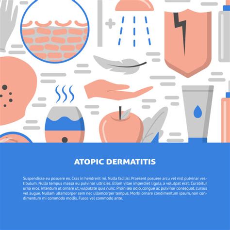 Atopic Dermatitis Illustrations Royalty Free Vector Graphics And Clip Art Istock