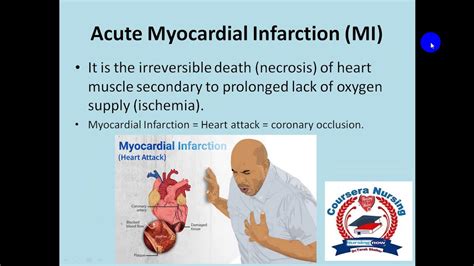 Angina And Myocardial Infarction Mi الذبحه الصدريه وجلطه القلب Youtube