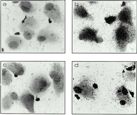 Productive and silent infection patterns associated with wild-type and ...