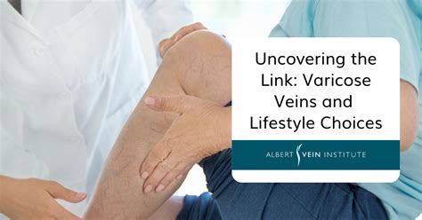 Understanding Varicose Veins And Contributing Factors