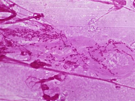 Haemophilus Gram Stain