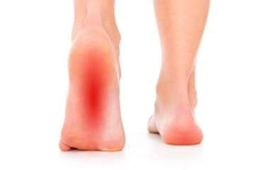 Plantar Fasciitis Treatment RICE Method To Reduce You Heel Pain Today