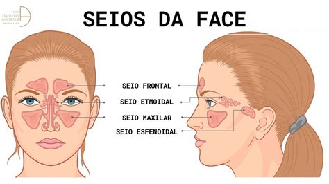 Espessamento Mucoso Maxilar Belo Horizonte Mg