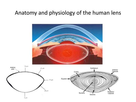 PPT Cataract And Cataract Surgery PowerPoint Presentation ID 3518536