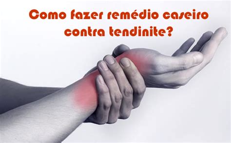 Como Fazer Rem Dio Caseiro Para Tendinite