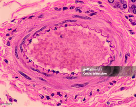 Artery Anatomyshows Layers Or Tunics Tunica Interna 100x High-Res Stock Photo - Getty Images