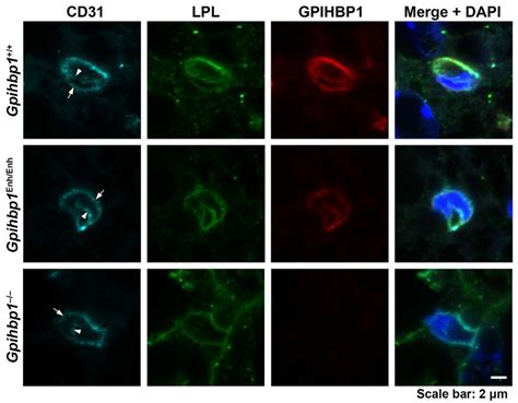 LPL Reaches The Capillary Lumen In The Brown Adipose Tissue Of Gpihbp1