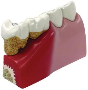 Gpi Anatomicals Basic Teeth Model Ward S Science