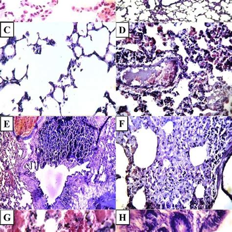 A Photomicrograph Of A Lung Section From A Rat In Control Group