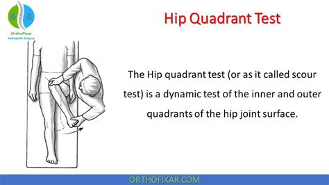 Hip Quadrant Test Orthofixar 2025