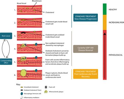 Atherosclerosis Archives Longevitytechnology