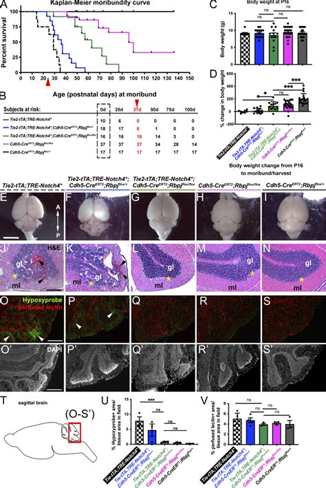 Endothelial Deletion Of Rbpj From P Reduced The Time To Moribundity