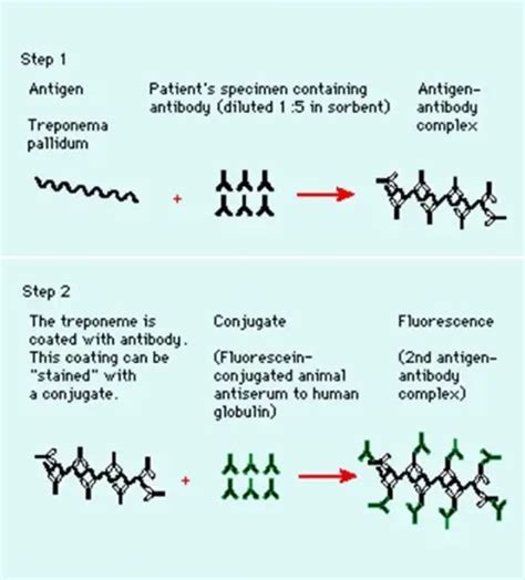 Fta Abs Test Principle Procedure Results And Interpretation