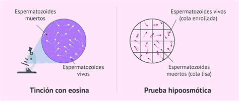 Cómo se determina la vitalidad espermática