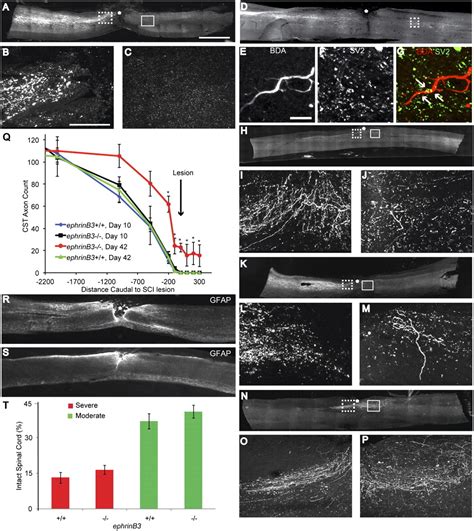 Myelin Derived Ephrinb Restricts Axonal Regeneration And Recovery