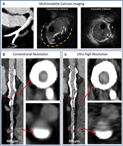 Frontiers The Role Of Invasive And Non Invasive Imaging Technologies