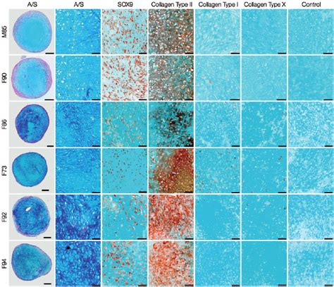 Histological And Immunohistochemical Examination Of Day 21 Hac Pellet