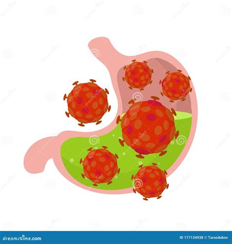 Human Magen Virusinfektion Verdauungsprobleme Vektor Abbildung