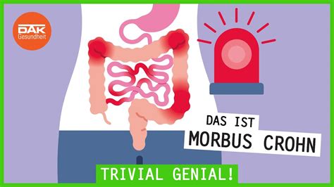 Das Ist Morbus Crohn Trivialgenial Dak Gesundheit Youtube