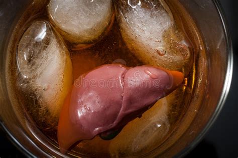 Alcoholic Liver Damage And Cirrhosis Concept With A Liver In A Glass Of