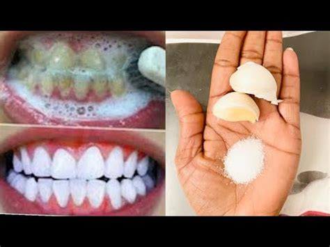 White Teeth At Home In 3 Minutes How To Have Natural White Teeth In 3