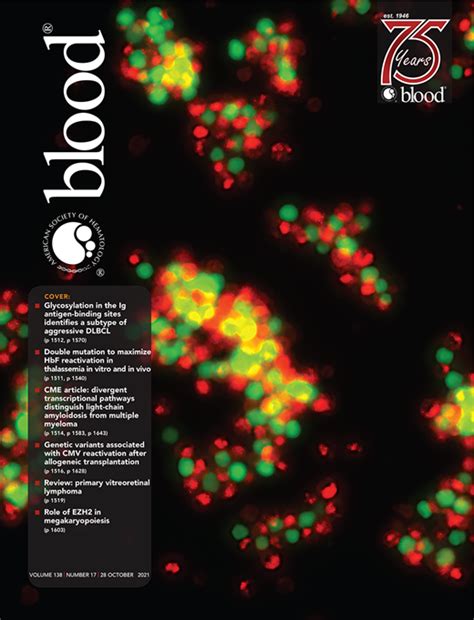 amyloidosis  multiple myeloma blood american society