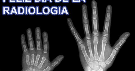 Enfoque Radiologico Feliz Día De La Radiología