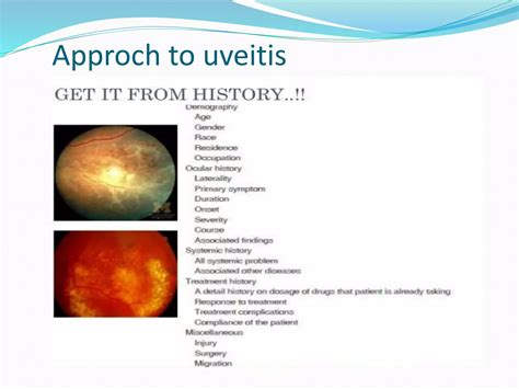 Posterior Uveitis By Dr Vijay Pratap Vipsy Ppt