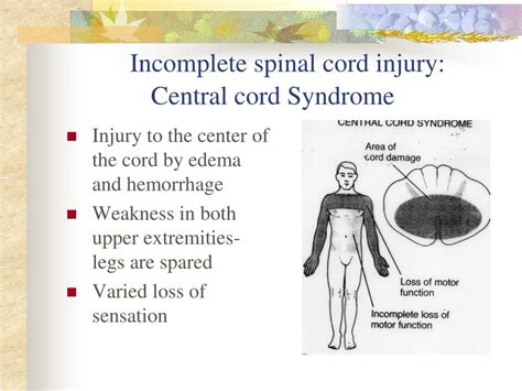 Ppt Traumatic Spinal Cord Injury Powerpoint Presentation Free