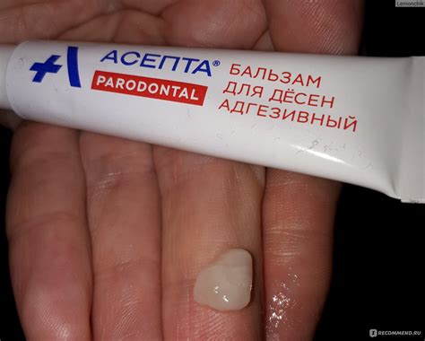 Бальзам для десен Асепта Адгезивный - «И почему же мне его никто не ...
