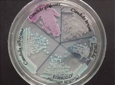 Differentiation Of Various Species Of Candida On Chrom Agar Download