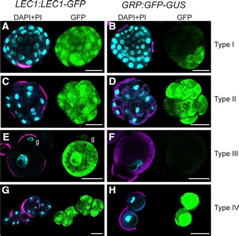 Figure 4 From The Histone Deacetylase Inhibitor Trichostatin A Promotes