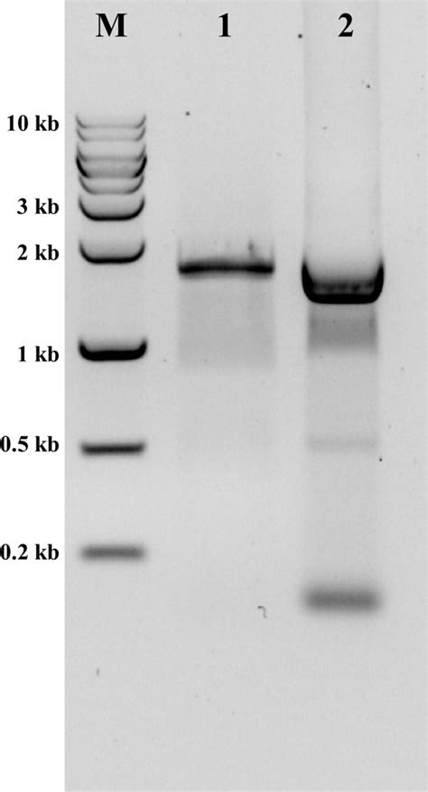 Agarose Gel Electrophoresis Of Amplified Pcr Fragments From