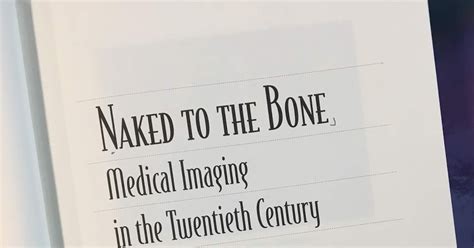 Intermediate Physics For Medicine And Biology Naked To The Bone