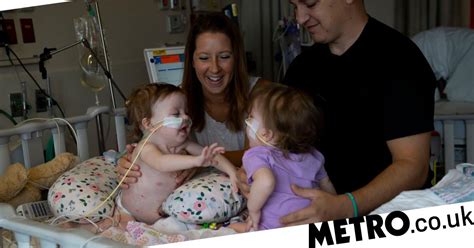 One Year Old Conjoined Twins Successfully Separated In 11 Hour Surgery Metro News