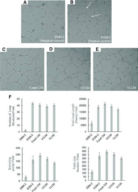 Proangiogenic Activity Of VCCM And VLCM In Vitro A HUVEC Tube