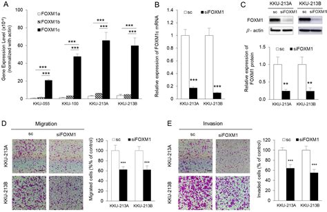 Foxm1c Is The Predominant Foxm1 Isoform Expressed In Cholangiocarcinoma