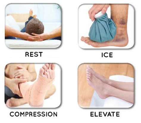 Treating injuries using RICE method • Bodybuilding Wizard