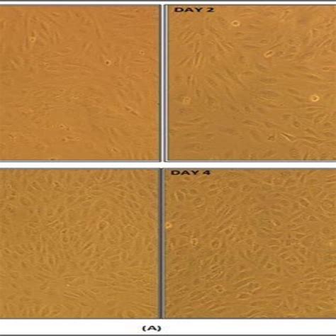 A Human Umbilical Cord Vein Endothelial Cells Huvecs Culture And