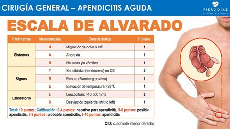 ESCALA DE ALVARADO Apendicitis Aguda