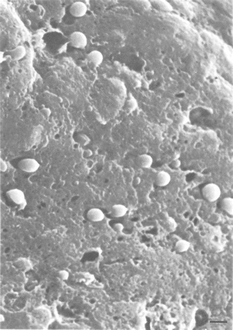 Scanning electron micrograph of the outer surface of the tip of a ... 