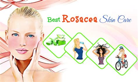 22 Best Natural Rosacea Skin Care Tips Experts Revealed