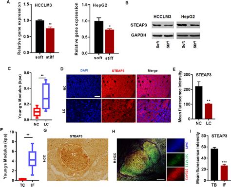 Matrix Stiffness Mediates The Expression Of STEAP3 In Cirrhotic HCC A